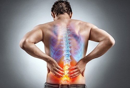 Sciatica Treatment