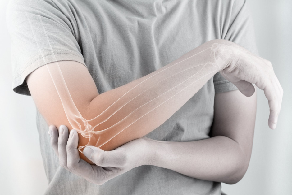 Elbow pain can significantly disrupt your daily activities, whether it's caused by an injury, overuse, or a medical condition.