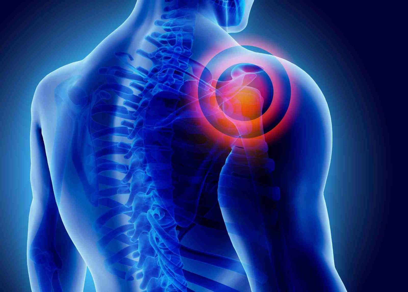 Shoulder pain is a common issue that can disrupt daily activities and lower quality of life.