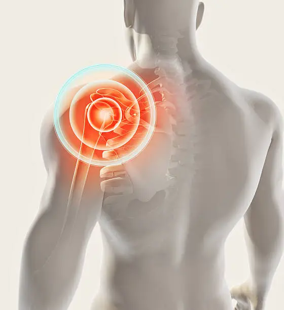Shoulder Pain Treatment In Sagar