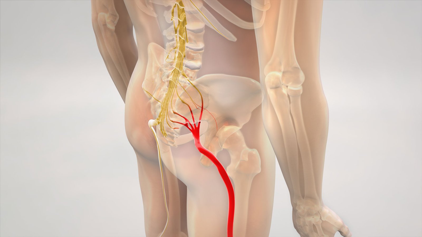 sciatica-pain-treatment-akola